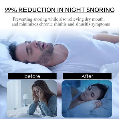 HushBuddy ELEVATE+ Anti snoring Nose Strips HushBuddy™